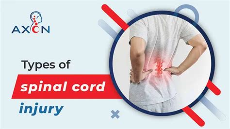 Types Of Spinal Cord Injury Know Difference From Critical Injuries