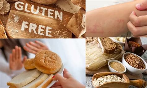 Gluten Hassasiyeti ve İntoleransı Nedir SiberHane