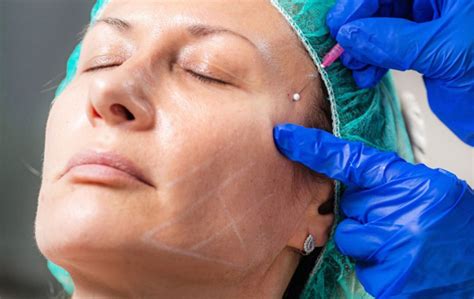 Medicina Estética Facial Clínica Delille a sua Clínica em Coimbra