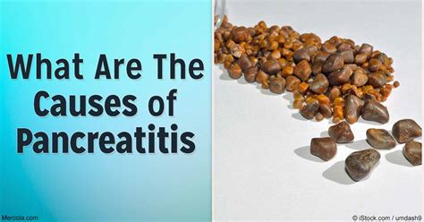 What Are The Causes of Pancreatitis?