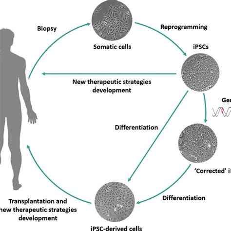 Cell Therapy Strategies Using IPSC Derived Cells Patient Specific