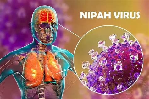 Virus Nipah Como Se Transmite - ¿Qué es el virus Nipah y qué tan peligroso es?