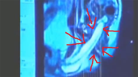 Das ist kein Tumor sondern Sex in der MRT Röhre