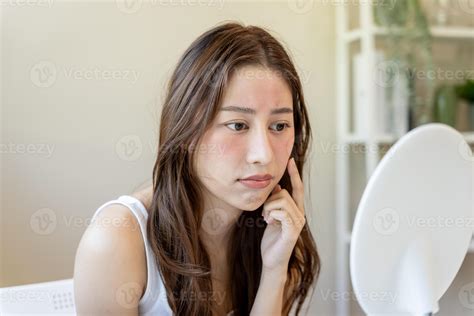 Young woman asian are worried about faces Dermatology and allergic to