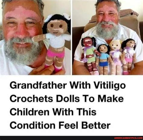 grandfather  vitiligo crochets dolls   children