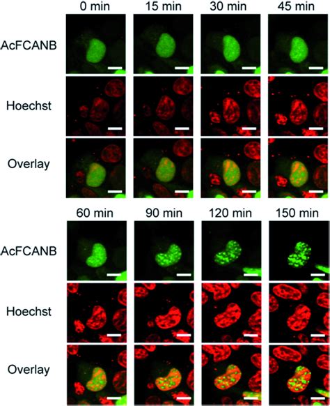 Live Cell Imaging Of Localization Of PYP 4RHP1a Expressed In HEK 293T