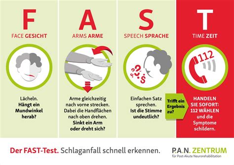 Fast Test Schlaganfall Schnell Und Ohne Vorwissen Erkennen