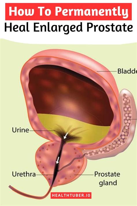 Mini Micro G String Bikini Bottoms Extreme Micro Bikinis Skinzwear Artofit