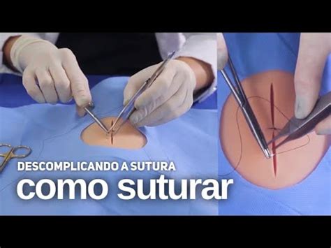 O Que Significa Suturar