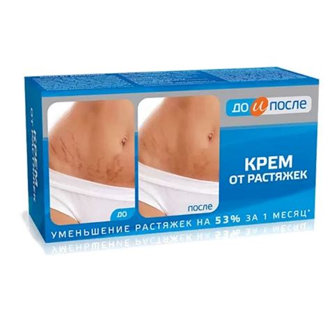 Крем от растяжек Twins Tec До и После, 100 мл - купить в Баку. Цена ...