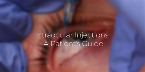 Intraocular Injections A Patient S Guide Island Retina