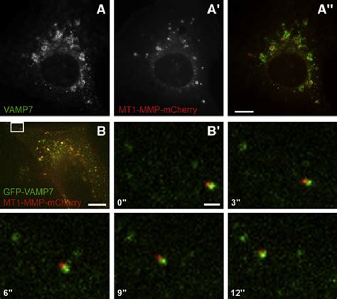 MT1 MMP Is Trafficking In VAMP7 Positive Compartments A A 00