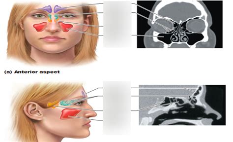 sinuses Diagram | Quizlet