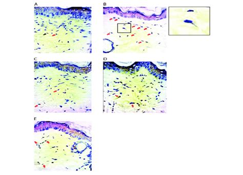 Immunohistochemistry Staining Showing 8 Ohdg Expression In Wistar Mice Download Scientific