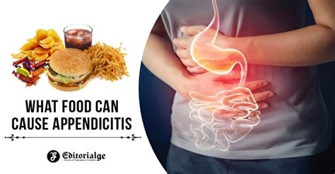 What Food Can Cause Appendicitis [foods You Should Avoid]