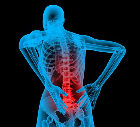 Back Pain Research And The Treatments Monash Lens