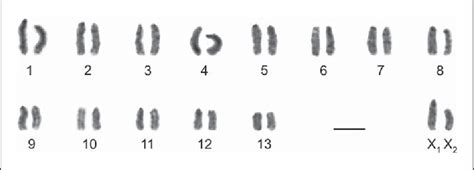 Figure From Sex Chromosome Pairing And Extensive NOR Polymorphism In