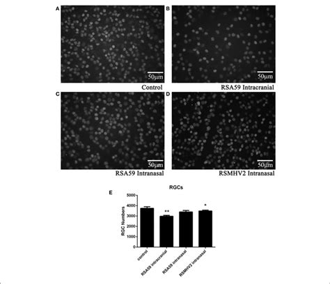 Rsa59 Infection Induces Rgc Loss Representative Photos Illustrate