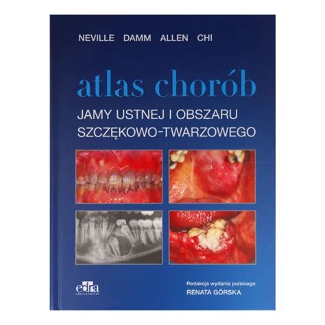 Edra Urban Partner Atlas chorób jamy ustnej DentalTree Internetowy