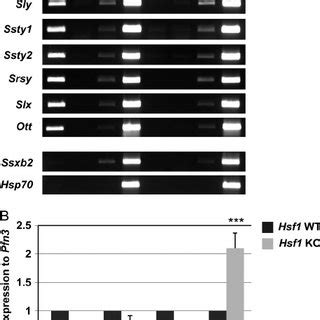 HSF1 Is A Transcriptional Regulator Of Sex Chromosomal Multicopy Genes