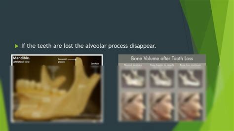 Solution Alveolar Bone Studypool