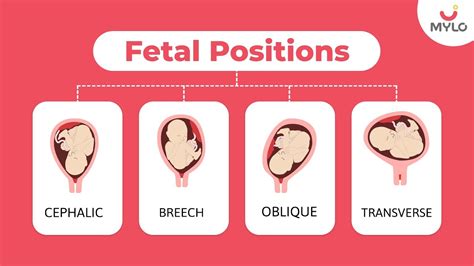 Types Of Fetal Positions Types Of Fetal Positions During Pregnancy