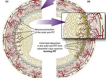 Does LDL Particle Size Really Matter? | Resource Your Health