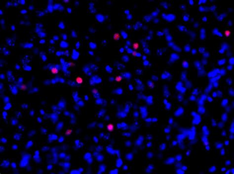 Artifact Or Positive C Fos Staining Researchgate