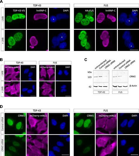 Nuclear Export Of TDP 43 And FUS Is CRM1 Independent A Heterokaryon