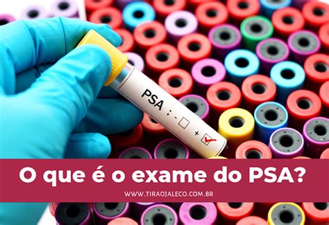 Preparação Para O Exame De Psa - Tudo Sobre O Exame Do Psa – Exame PSA: saiba como é feito e como é a ...