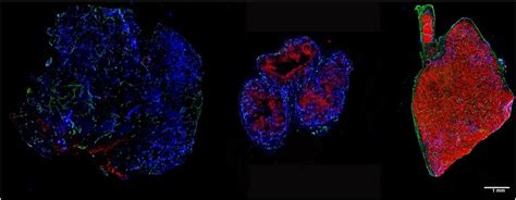 Example Sections Of 3 Different Tumor Models From Left To Right