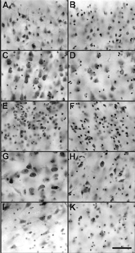 Representative photomicrographs of 200 m m thick coronal sections ...