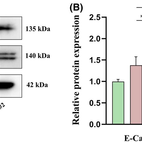 Effect Of Nucb Nesfatin Knockdown On The Ecadherin And Ncadherin