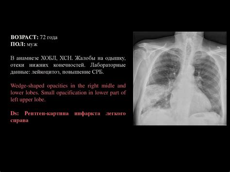 Лучевая диагностика неотложных состояний - online presentation