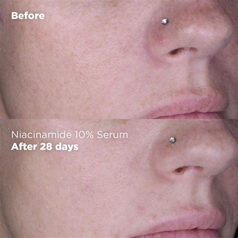 niacinamide  serum skin republic skin republic south africa