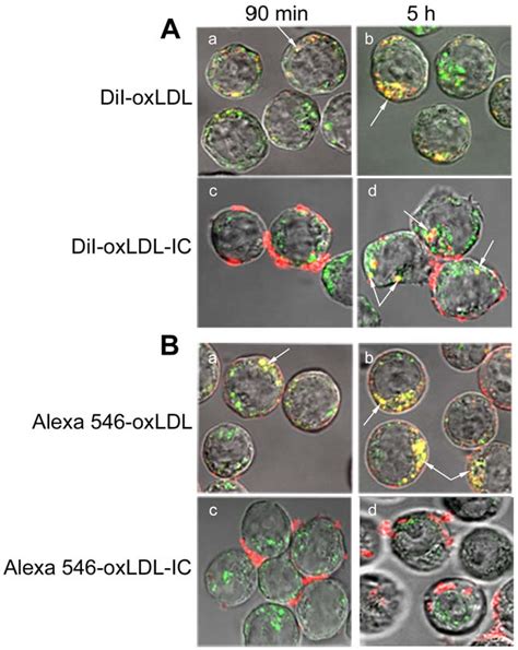 Figure 1 From Differential Trafficking Of Oxidized Ldl And Oxidized Ldl