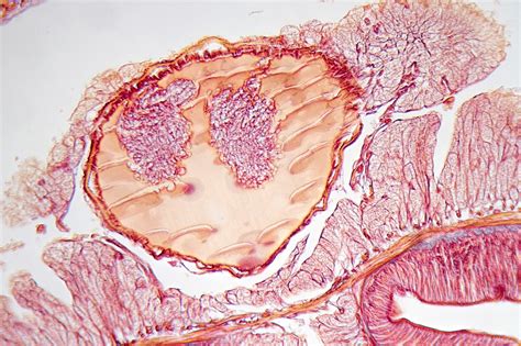 Free photo: Earthworm Under Microscope - Annelida, Study, Structures - Free Download - Jooinn