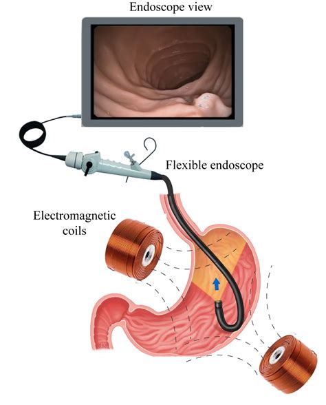 Understanding the Distinction Between Endoscopes and Borescopes