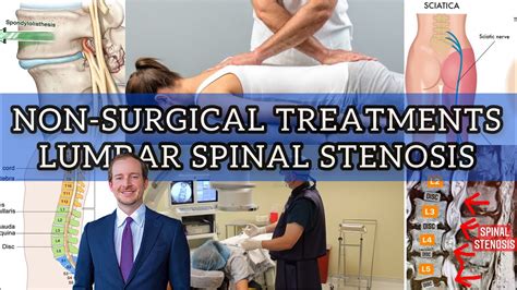 Non Surgical Treatment For Lumbar Spinal Stenosis Part 1 YouTube