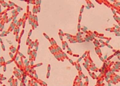 Staining Microscopic Specimens | Microbiology