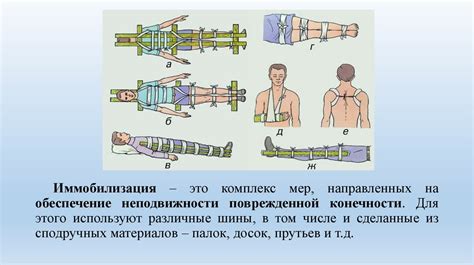 Переломы. Первая помощь при переломах - презентация онлайн