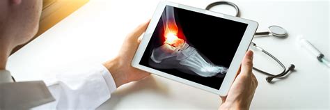 Ankle Arthroscopy | TruOrtho Orthopaedic Specialists