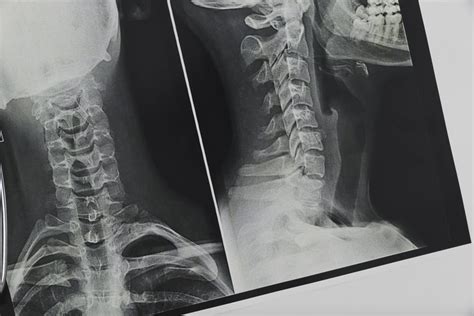 Mengenal 8 Jenis Pemeriksaan Radiologi Kavacare