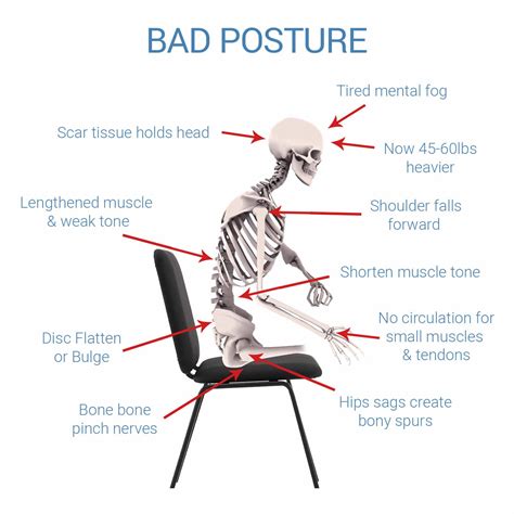 Sitts Posture Cushion | Back Pain Relief by Improving Posture