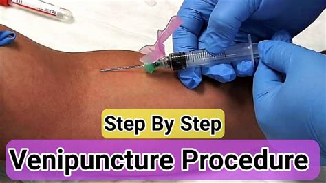Venipuncture Procedure Step By Step How To Take Blood Phlebotomy