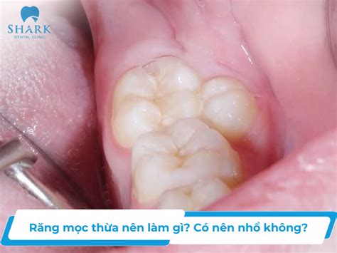 Rang Moc Thua Nen Lam Gi Telegraph