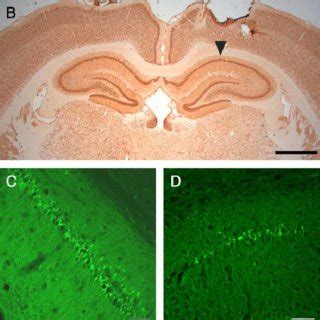 Eiav Gdnf Protects Rat Hippocampal Neurons Against Nmda Excitotoxicity