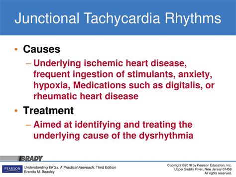 Ppt Introducing The Junctional Rhythms Powerpoint Presentation Free Download Id 3366298