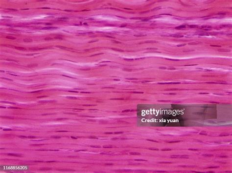 39 Collagen Fibers Histology Stock Photos, High-Res Pictures, and ...