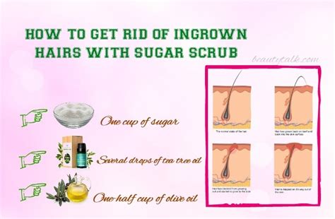 7 Ways To Vanquish Pus-Filled Pests: The Ultimate Guide To Eradicating Ingrown Hairs On Your Face